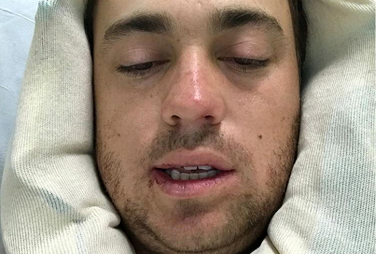 How do you stop Justin Thomas? Take him to the dentist
