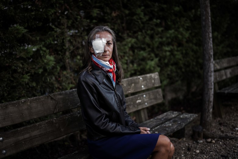 Woman struck in eye at Ryder Cup says fans “were taking pictures” instead of helping